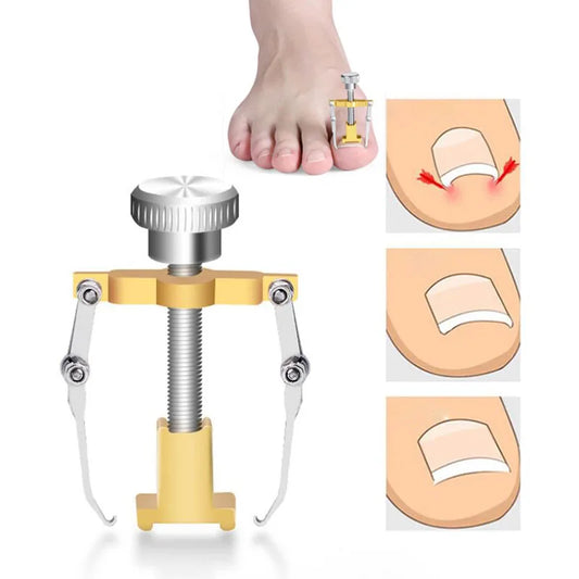 Correcteur des ongles d'orteils